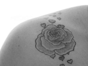 Rimozione Tatuaggi con il laser dott. Scioscia Roma